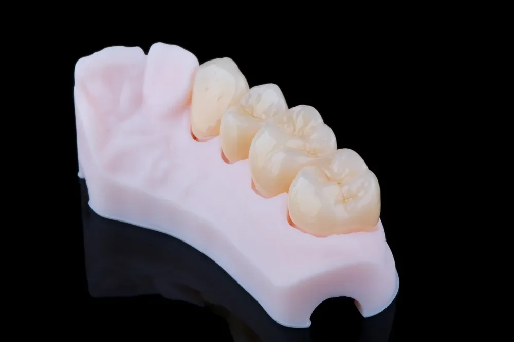 Strength Meets Beauty: Zirconium Crowns – A Modern Solution for Dental Tourism in Turkey