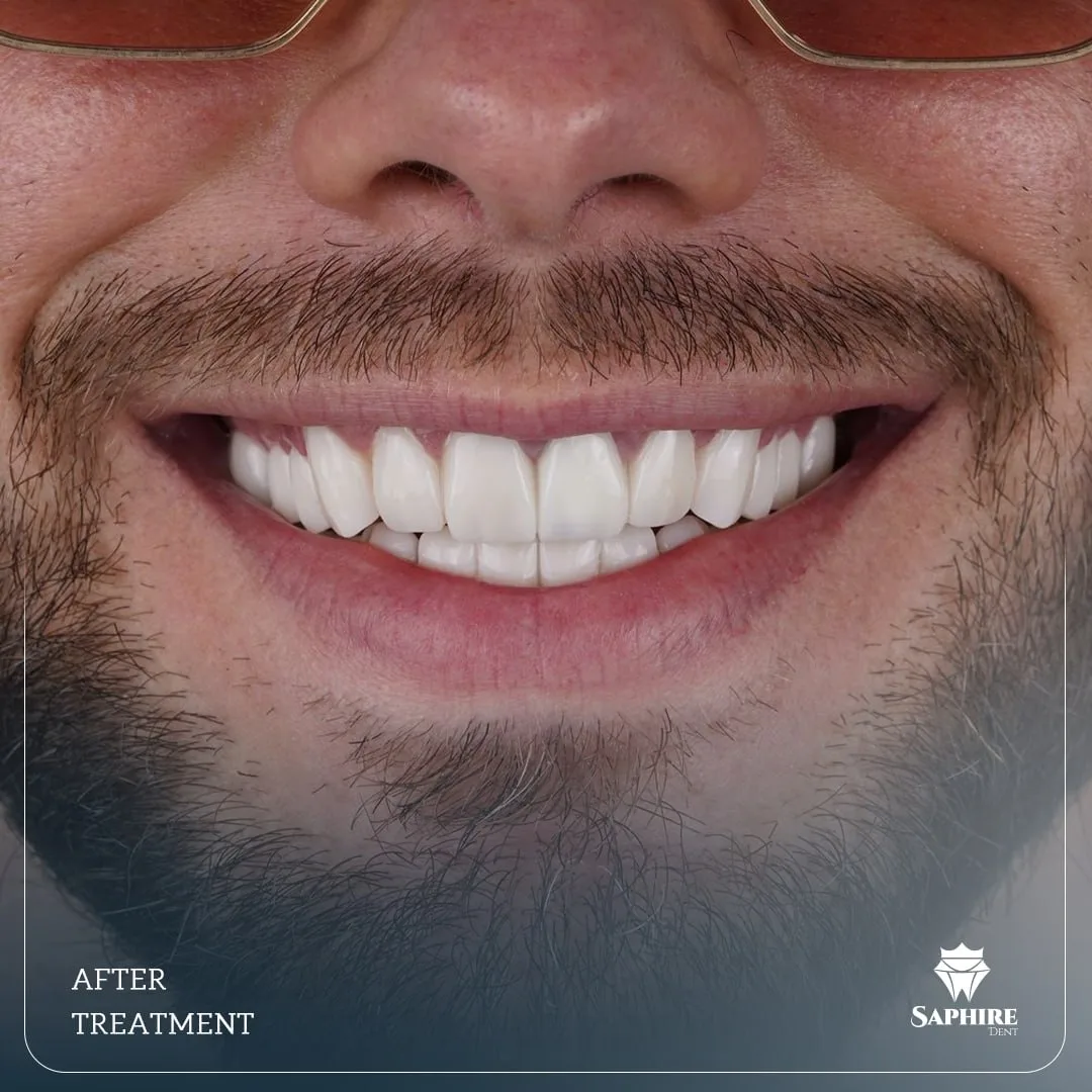 After treatment