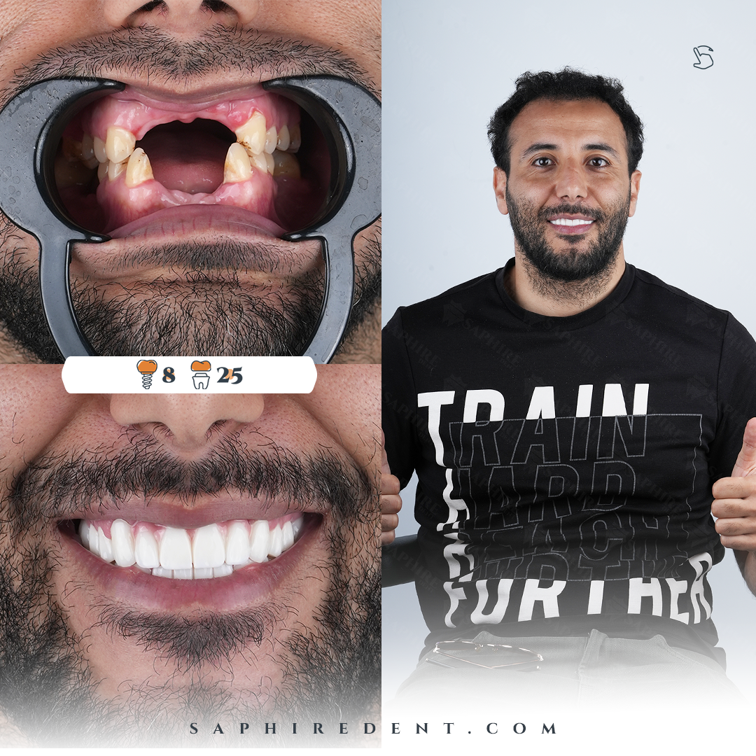 Dental treatment results