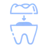 Smile Design